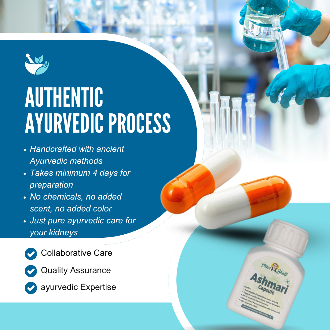 ShreeBhatt Ashmari Capsule 30 Capsules