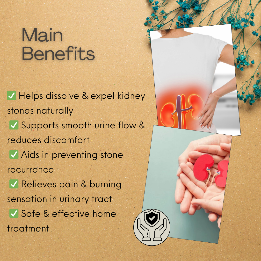 ShreeBhatt Ashmari Capsule 30 Capsules