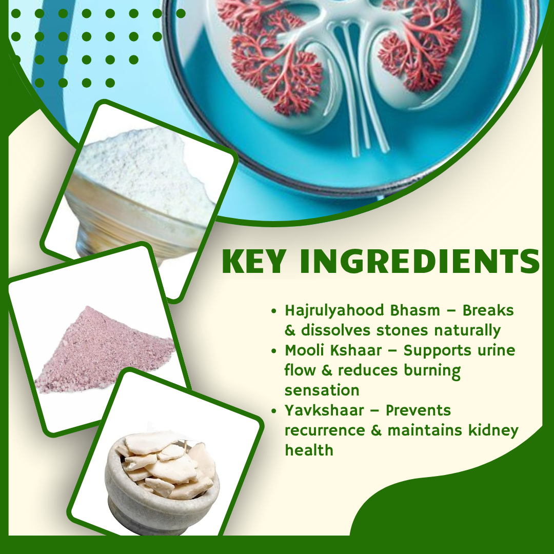 ShreeBhatt Ashmari Capsule 30 Capsules